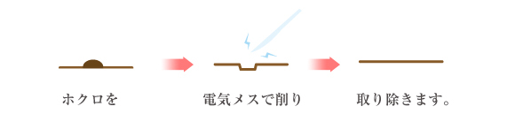 Ｅシェーブ法