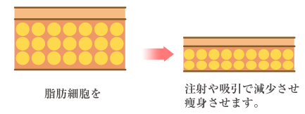 脂肪細胞説明