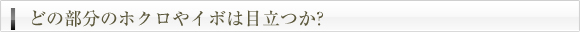 どの部分のホクロやイボは目立つか?