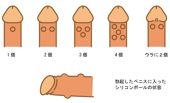 シリコンボール説明イラスト"