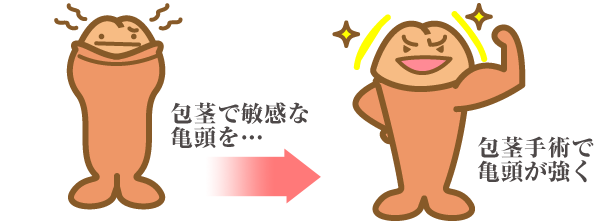 包茎手術イラスト