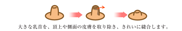 乳首形成説明イラスト