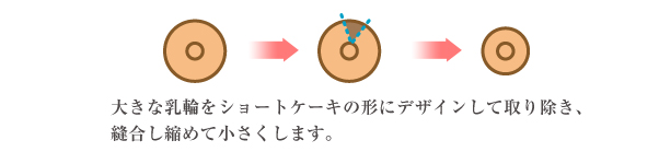 乳輪縮小説明イラスト