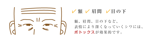 ボトックス説明イラスト01
